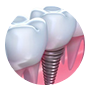 endodontia