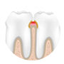 periodontia